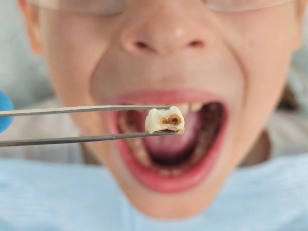 Best Pediatric Emergency Dentist in Woodcrest, CA
